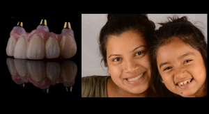 Mother with Daughter after fixed teeth