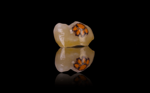 paw print on a tooth