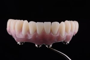 After photo of bottom teeth